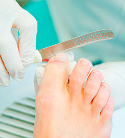 footcare-1